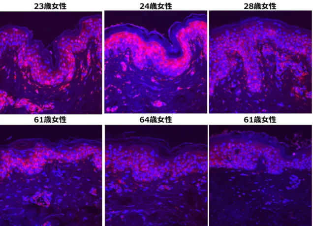 Fig. 3-1  ヒト腹部皮膚における ENO1 の局在 