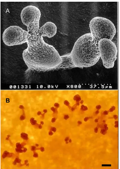 図 1-2.  細菌溶解性粘液細菌の子実体－細菌溶解性菌株.  A.  Stigmatella  aurantiaca  DW4  の 子実体の走査電子顕微鏡像（不藤・山中,  1992）．子実体は、柄の先端に球状－卵型の胞子嚢 を持ち、その中に多数の粘液胞子（myxospore）を含む．B