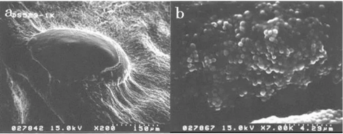 図 3-10.  OTU-1 の菌株 SIR-1 T   の SEM 画像．(a)  粘質物からなる薄い膜で覆われた子実体様 細胞塊（明瞭な外被は観察されない）;  (b)  子実体様細胞塊の内部の粘液胞子(内部に密集す る胞子  [myxospore]  と推定される多数の球状細胞）．     以上のような子実体様の細胞塊や胞子の形態的性質については，Nannocystis 属の陸生 粘液細菌との類似点も認められた（Reichenbach,  1989）。相違点として、Nannocystis  属 の子実