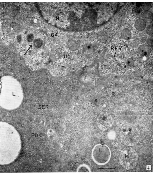Fig. 4  Undifferentiated cell and partially differentiated cell. Lipids increase  in size and number with the increase of small vesicle (SER). High  dense vesicular granule seemed to be orlginated from Golgi apparatus is  observed (arrow) 