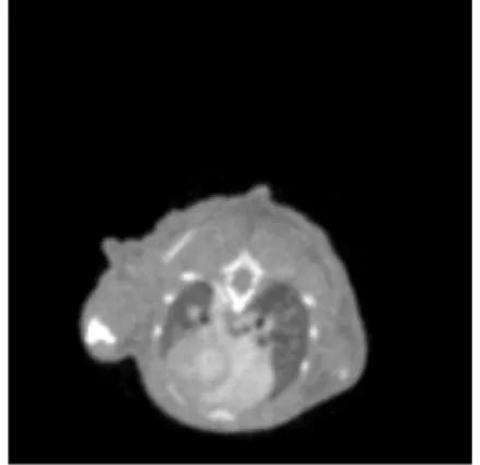 図 3.15: X 線 CT 画像 ( 胸部 ) 図 3.16: 図 3.15 の画像データから臓器を同 定した結果 表 3.2: 各部位の濃淡値の抽出範囲 各部位 濃淡値の範囲 骨 215-255 血管 188-288 心臓 196-224 肺 89-156 肝臓 174-224 腎臓 188-230 脳 144-200 その他 68-255