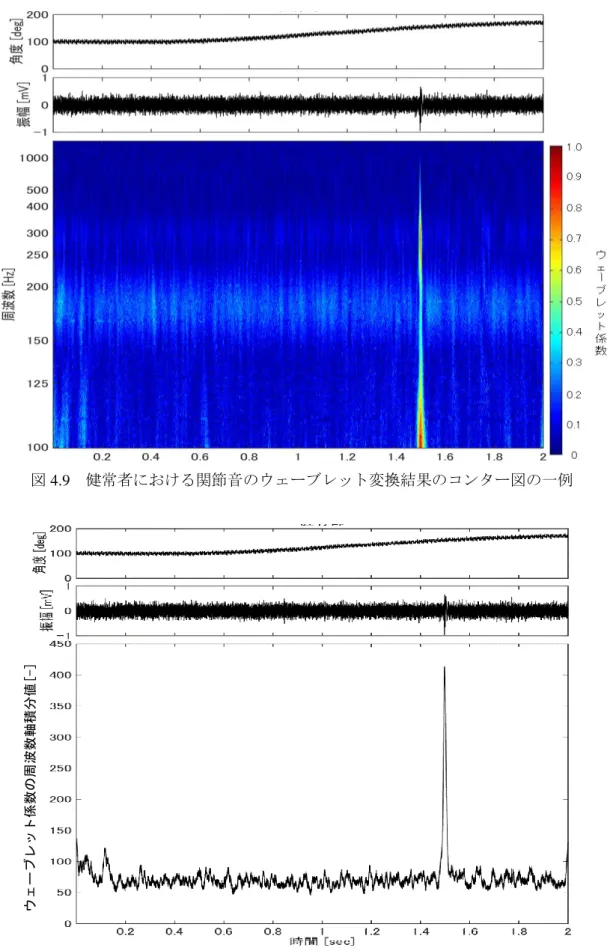 図 4.9  健常者における関節音のウェーブレット変換結果のコンター図の一例 
