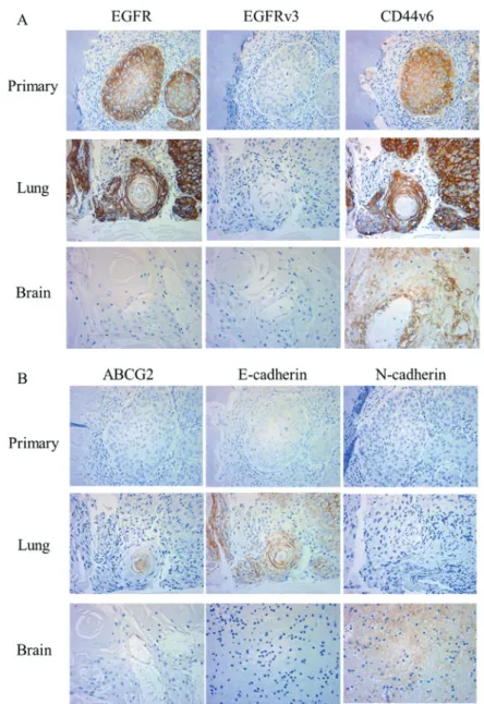 Figure 6. Representative immunohistochemical features of oral squamous cell carcinoma