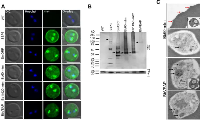 Fig 2. Expression and localization analysis of candidate proteins determined by indirect immunofluorescence antibody test (IFAT), Western blotting, and immunoelectron microscopy (IEM)