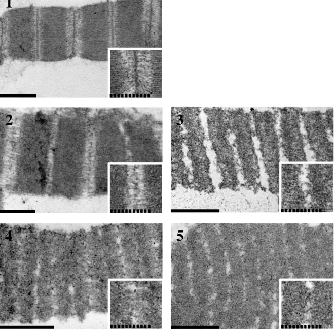 Fig. 2-4. Electron micrographs of myofibril of lizard fish.