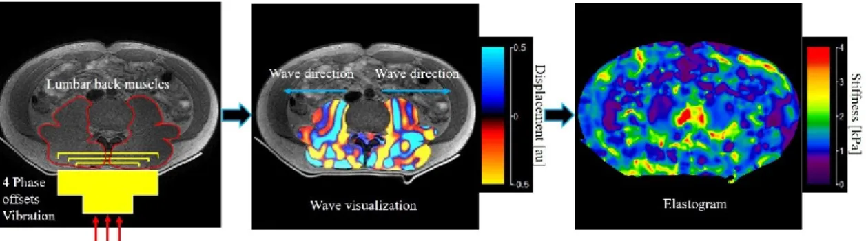 Figure 1.3 Steps required for Magnetic Resonance Elastography of lumbar back muscles. 