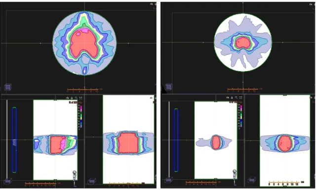 図 6.1  IMRT 線量検証に使用した AAPM TG-119 21) のモデルプランにおける 