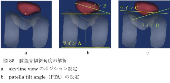 図 35  膝蓋骨傾斜角度の解析 