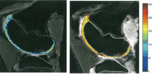 Fig.  2- 8 the  quantitative  image  of  the  cartilage  by  relaxation  time  T2-mapping  (a) and  T  1   p-mapping (b) in a porcine model.