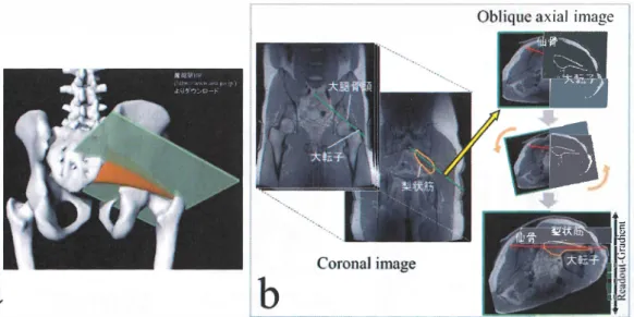 Fig.  5-5  b に示す ように，まず， turbo spin  echo  (TSE) シ ー ケン スを用いて殿部全体の