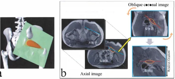 Fig. 5 -6 OC image の設定方法 a: OC image の模式 図 b: OC image 取得の手順