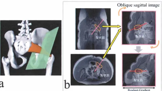 Fig. 6-1  OS image の 設定方 法 a: OS image の 模式図 b: OS image 取得の手 順
