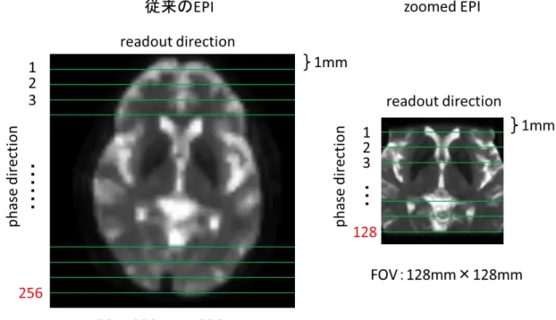 図 4-2  従来法と zoomed EPI 法でのサンプリング数の比較の例 