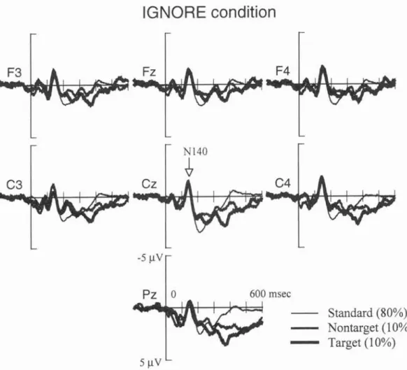 Figure  1: The waveforms of ERPs (grand average) for  the standard,        target stimuli in Ignore condition.