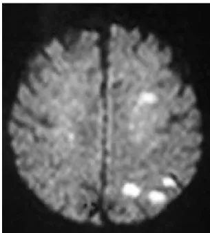 Figure 4.  Course of CEA before and during treatment.