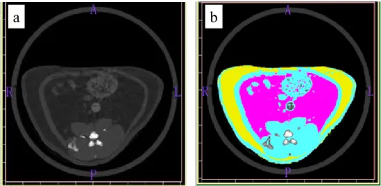 Figure 1.    Representative CT imaging for quantitative assessment of lesion area. (a): Raw gray scale scan  slice