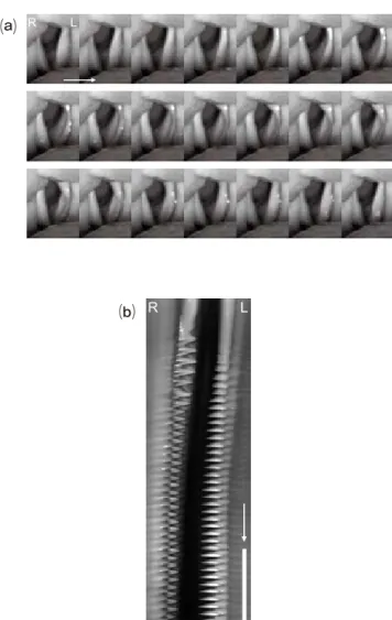 Figure 3.  Vocal fold vibration in a patient with left vocal fold  paralysis. (a) A sequence of images containing almost one glottal  cycle shown in 21 images (7.0 ms)