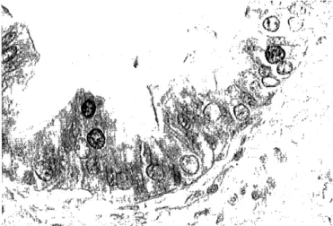 Fig  4.  Slight  expression  of  the  proliferating  nuclear  antigen        (PCNA)  was  observed in  the  lesion
