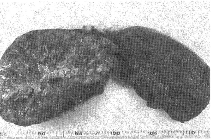 Fig.  4.  Cut  surface  of  the  tumor  (case  2)  showing  several  septum  toward  the  periphery  from  the  centrum.