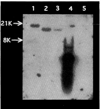Fig  2.  Southern  blot  analysis  of HTLV-1  integration  status  in patients  with  seropositive  T-cell  neoplasm