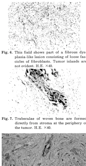 Fig.  7.  Trabeculae  of  woven  bone  are  formed        directly from stroma at  the  periphery  of 