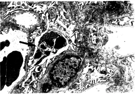Fig.  3.  Change  of  epithelial  cell; 