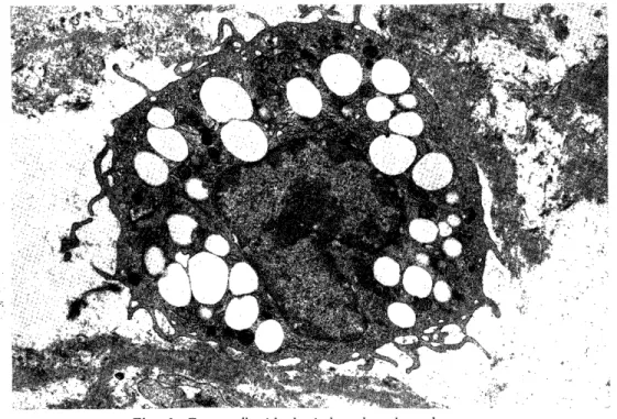 Fig.  6.  Foam  cell  with  the  indented  nucleus,  lysosomes,          mitochondria and  cytoplasmic processes