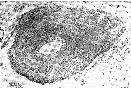 Fig.  3.  A  mesenteric  artery  of  1-year  experimental  rat. 