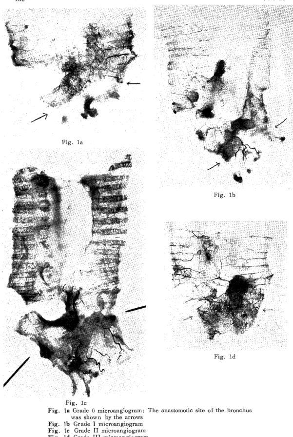 Fig.  lb