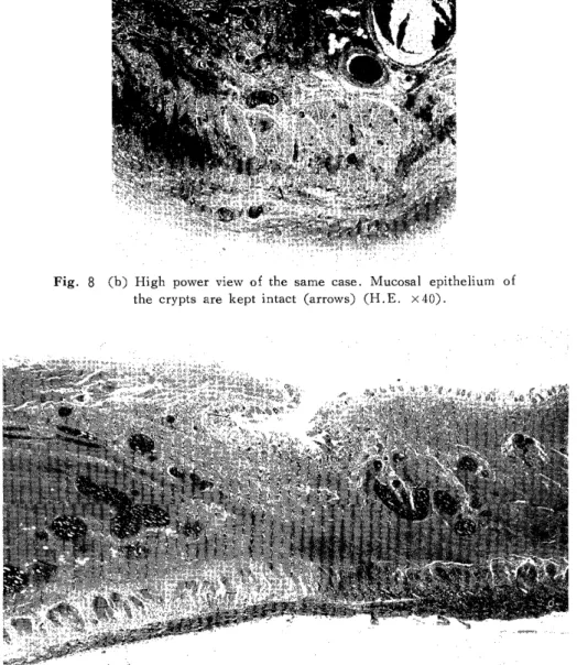 Fig.  9  Intestinal  wall  of  the  non-occlusive  segmental  infarction  (case  12). 