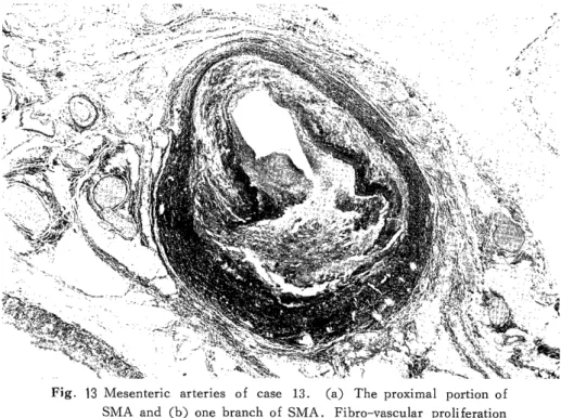 Fig.  13  Mesenteric  arteries  of  case  13.  (a)  The  proximal  portion  of        SMA  and  (b)  one  branch  of  SMA