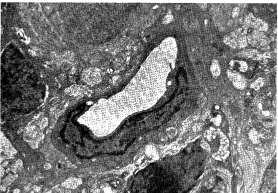 Fig.  1  Cross  section  of  retinal  capillary  of  normal  rat  (x  6800)