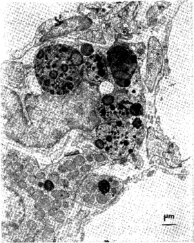 Fig  9.  The  zona  reticularis  of  the  third  group  (6        hours). The numerous mitochondria 