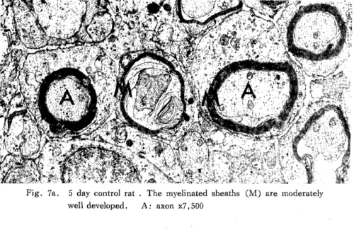 Fig.  7a.  5  day  control  rat  .  The  myelinated  sheaths  (M)  are  moderately           well  developed