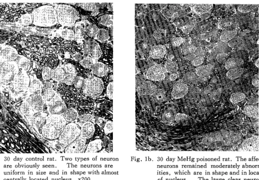 Fig.  la.  30  day  control  rat.  Two  types  of  neuron          are  obviously seen