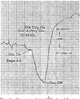 Fig. 3b  Change in  relative slope (increased)  in        002  following temporary occlusion of small 