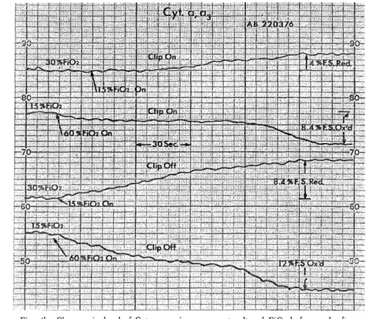 Fig.  4b  Changes  in  level  of  Cyt.  a,  a3 in  response  to  altered  Fi02  before  and  after        microanastomosis (temporary clip  "ON"  and  "OFF"  the  STA)