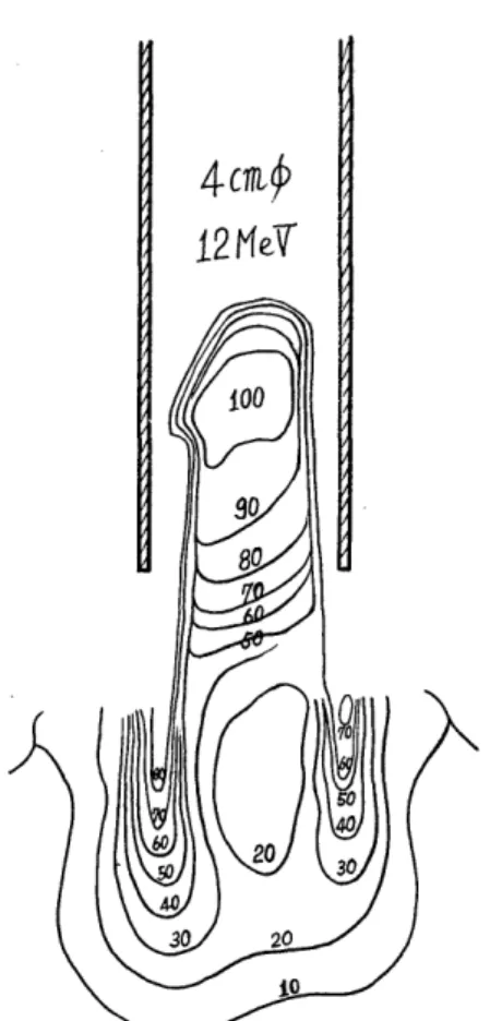 Fig.  4  Same  techique  as  Fig.  3,  except         irrnrliatinn condition of  12  MPV.