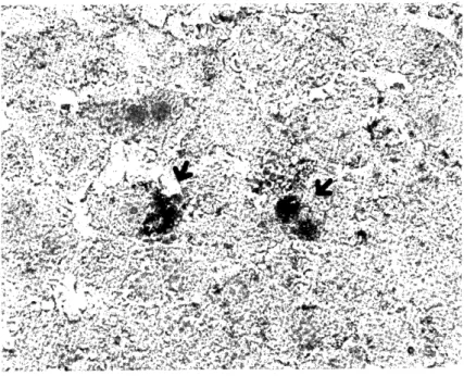 Fig.  5  The  liver  of  a  rat  of  the  5 %  group  (C)  .         Fat-staining with  Sudan  Ill ,  X  400