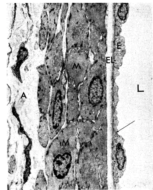 Fig.  1.  Control.  Normal  cerebral  basilar  artery  of  a  rabbit.  Endothelial  cells  (E)         form  continuously single thinn  layer  with  tight junctions (T  ) 