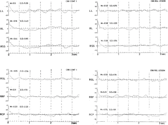 Fig.  4D.  Power  spectra  of  EEG.  Abbreviation,  see  Fig.  4B.