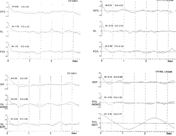 Fig.  1C.  Autocorrelograms  of  EEGs  before  (left)  and  20  minutes  after  destruction        (right)