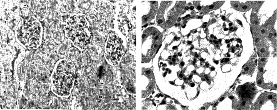 Fig.  5:  Glomerulus  of  a  rat  which  received  ho-        mologous soluble complexes every 12         hours  for  3  injections