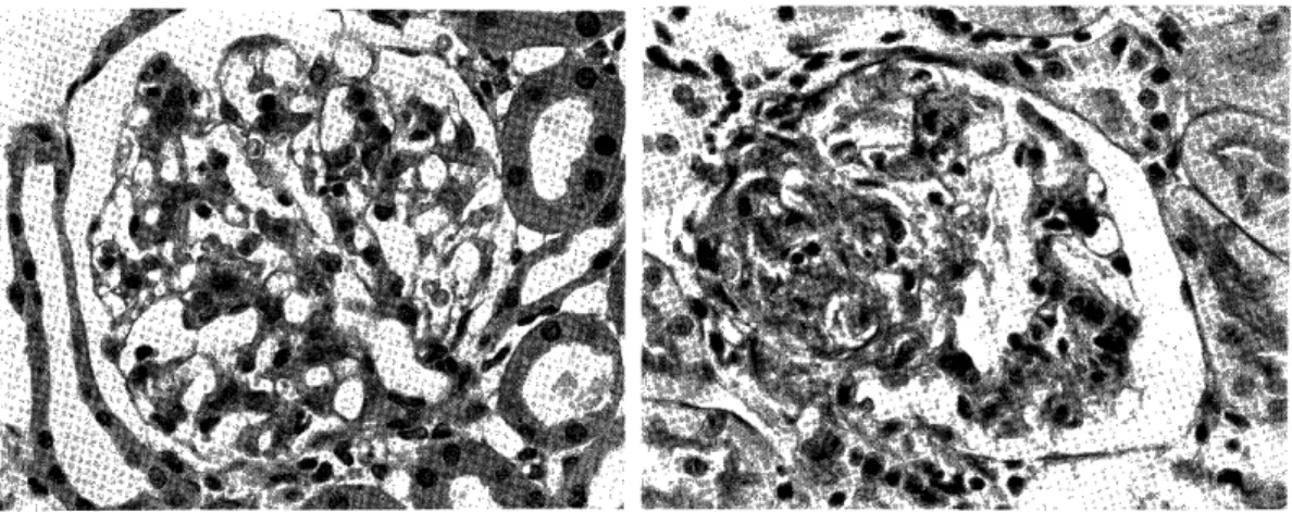 Fig.  10:  Glomerulus  from  a  rat  which  received         