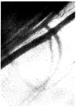 Fig.  3:Control,