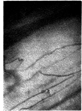 Fig.  12.  One  minute  after  injection  of  adrenaline.