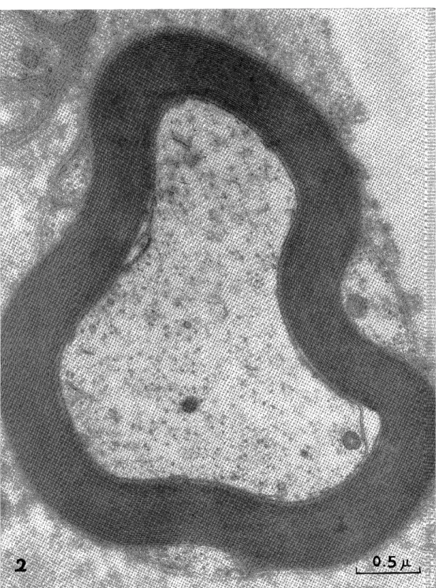 Fig  2  The  normal  structure  of  the  great  occipital  nerve  of  a  rabbit,  demonstrating           distinct inner mesaxon and  outer mesaxon x41,100.