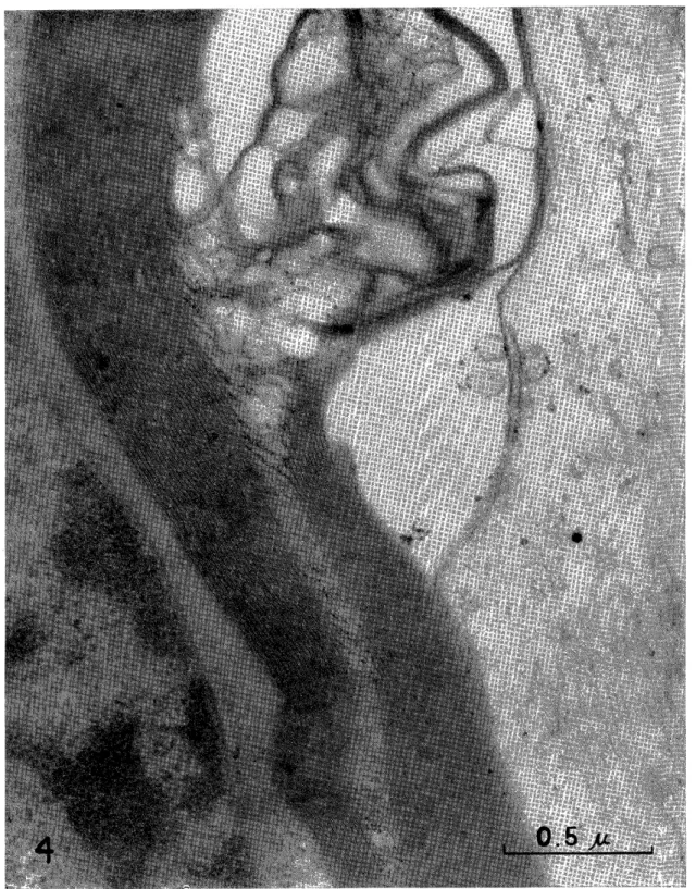 Fig.  4.  Changes  after  6  hours  of  local  cooling.  x63,700,