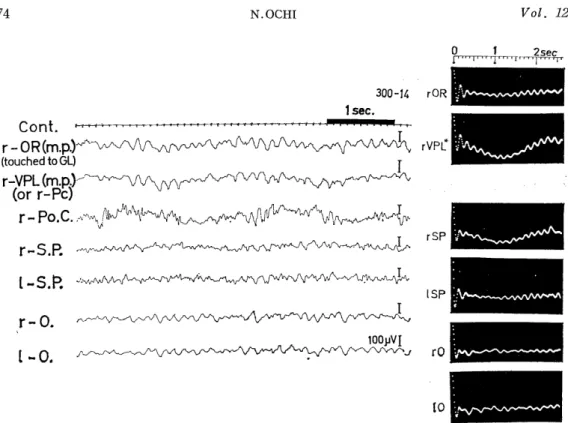 Fig.  2.3.  Background  EEGs  and  their  autocorrelograms  of  an  animal(300-14)  show-           ing  visually  evoked  potentials of  Group  II