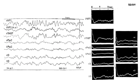 Fig.  2.4.  Background  EEGs  and  their  autocorrelograms  of  an  animal  (300-13)  show-           ing  visually  evoked  potentials of  Group  111
